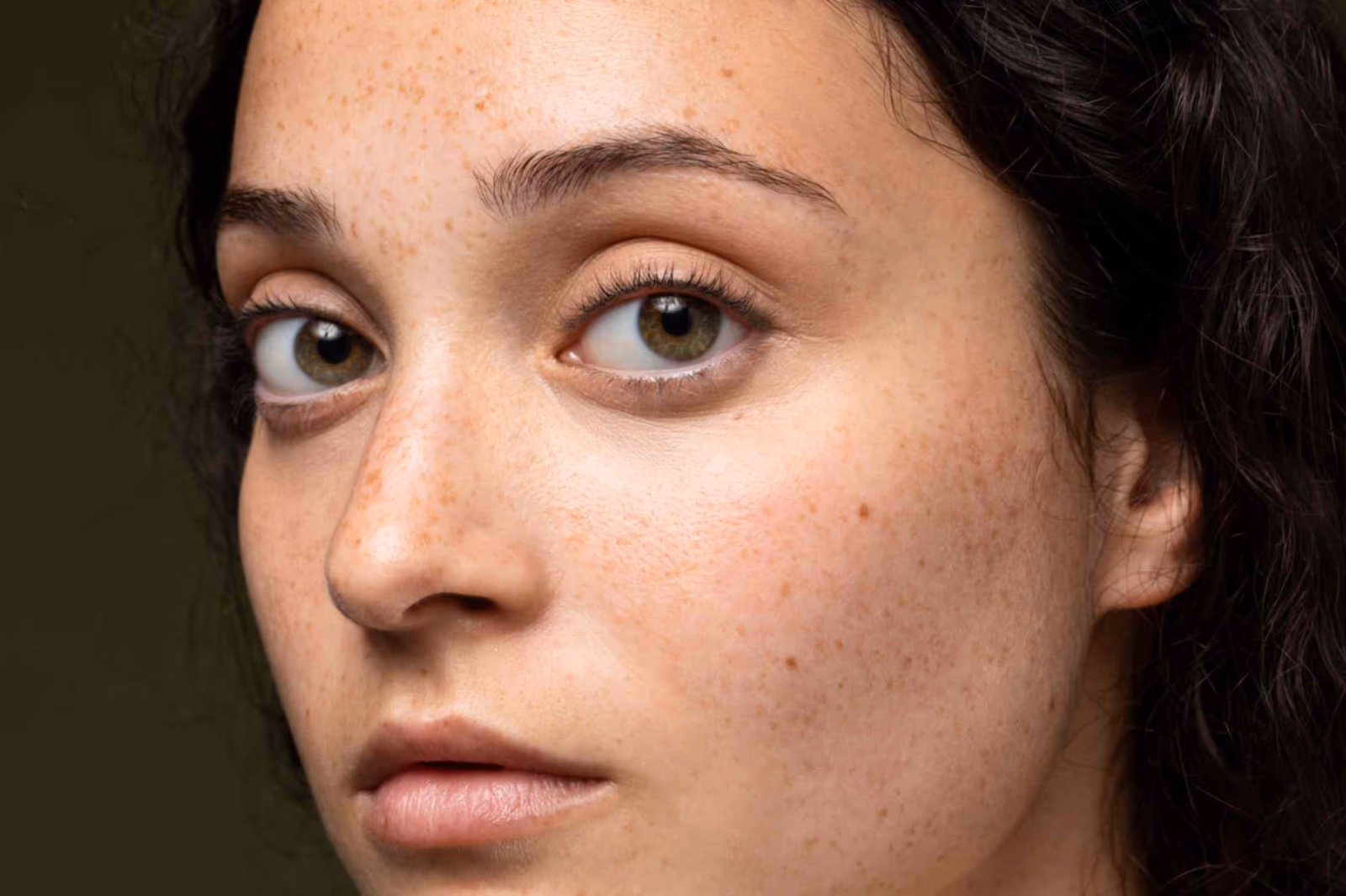 Dull/Pigmentation/Melasma