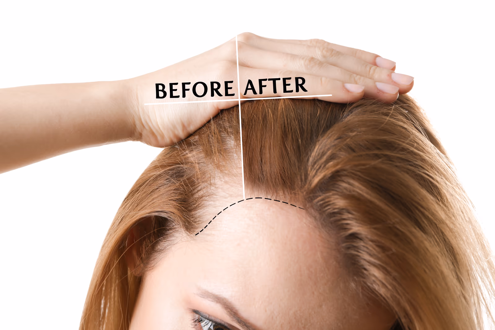 The Science of Magical Hair Growth Therapy