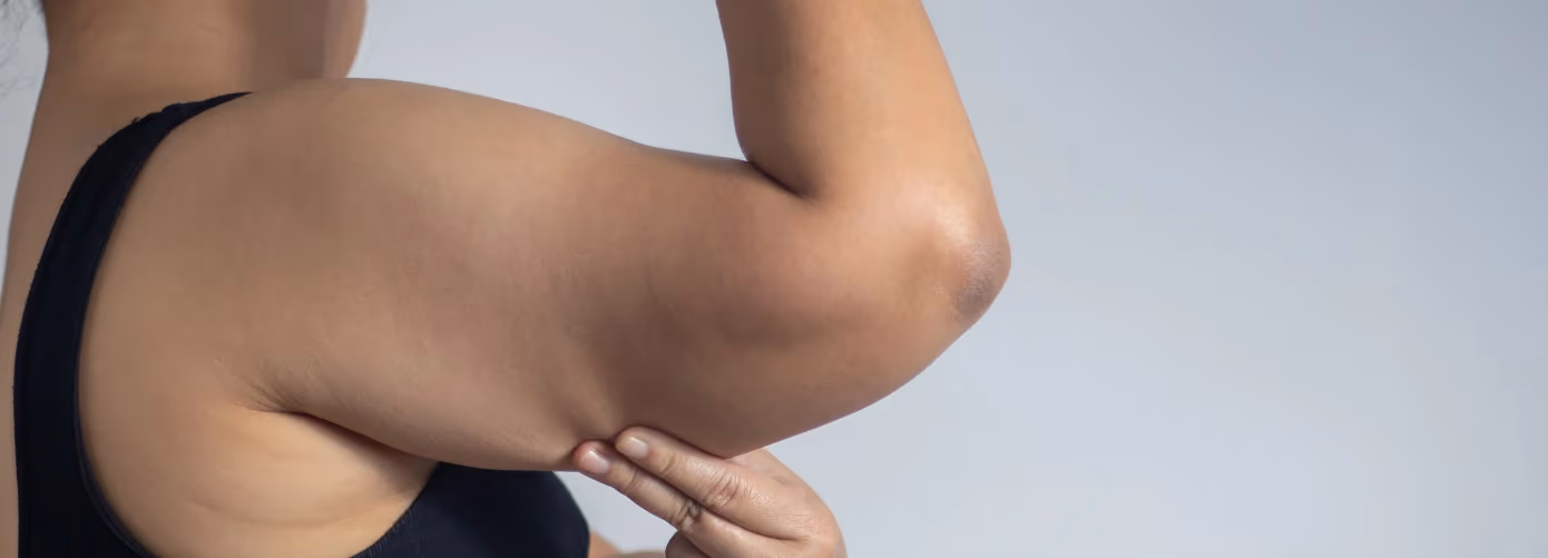 How to Reduce Arm Fat: Causes, Solutions & Best Ways to Tone Up