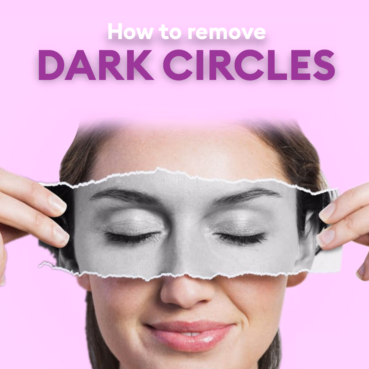How to remove Dark Circles