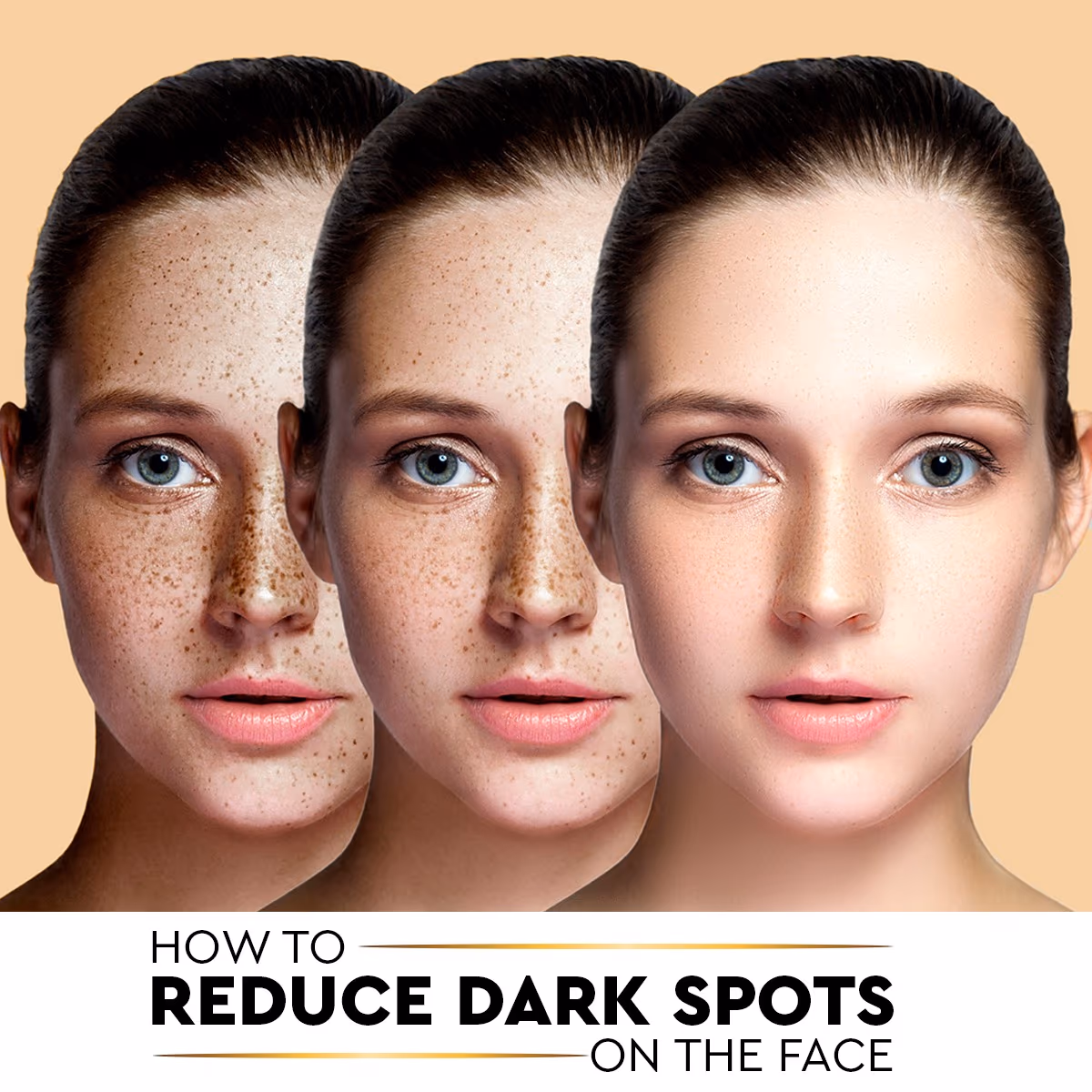 Dark spots on face: Causes & Solutions