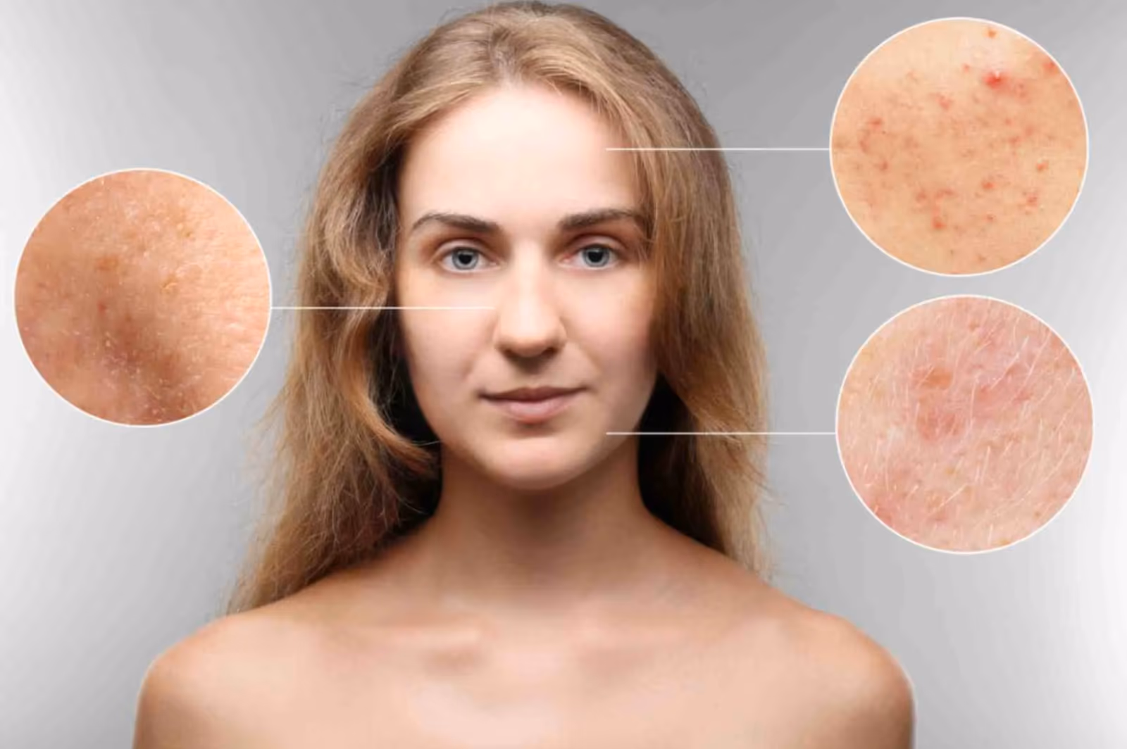 Understanding Skin Issues and the Role of Dermatologists in Pune
