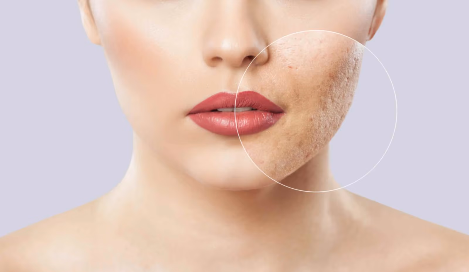 Best Dermatologists in Bangalore: Your Guide to Expert Skincare