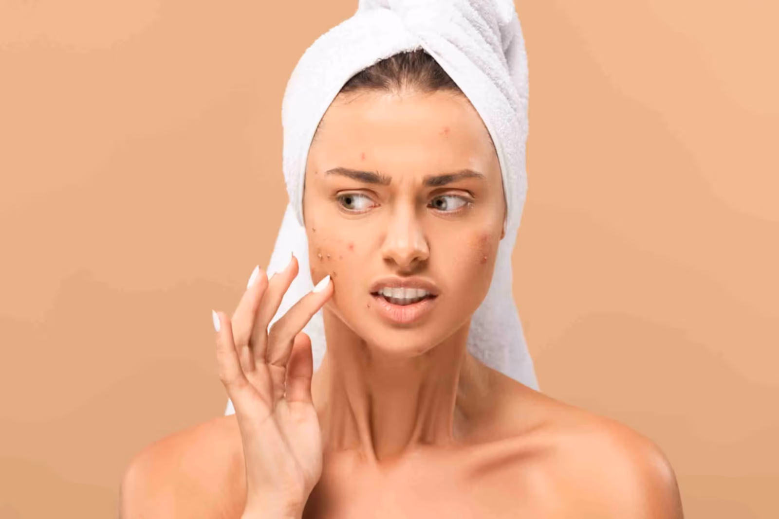 Acne Scar Treatment in Delhi: Cost, Procedure & Benefits