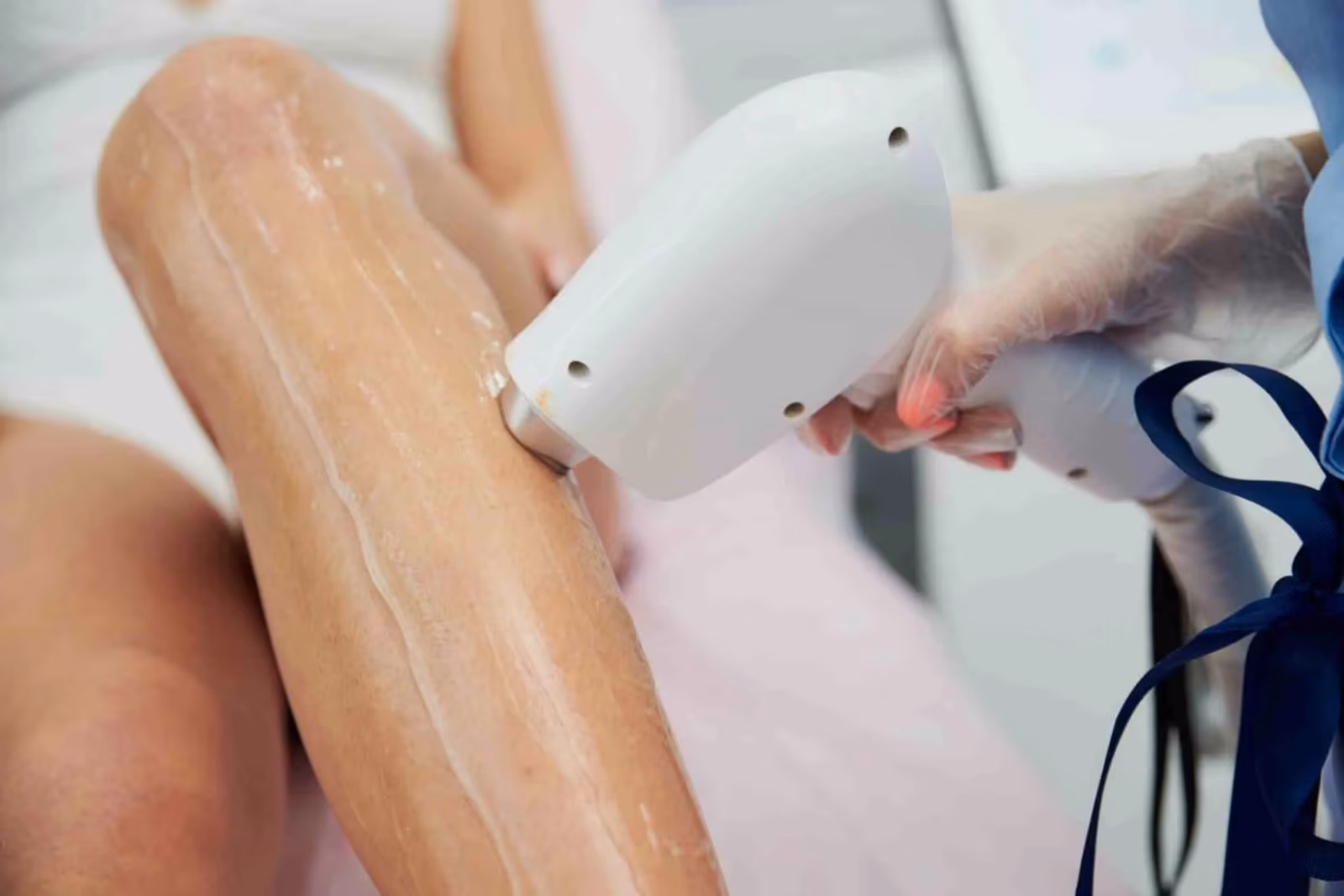 Laser Hair Removal in Ahmedabad | Cost, Procedure & Results | VLCC