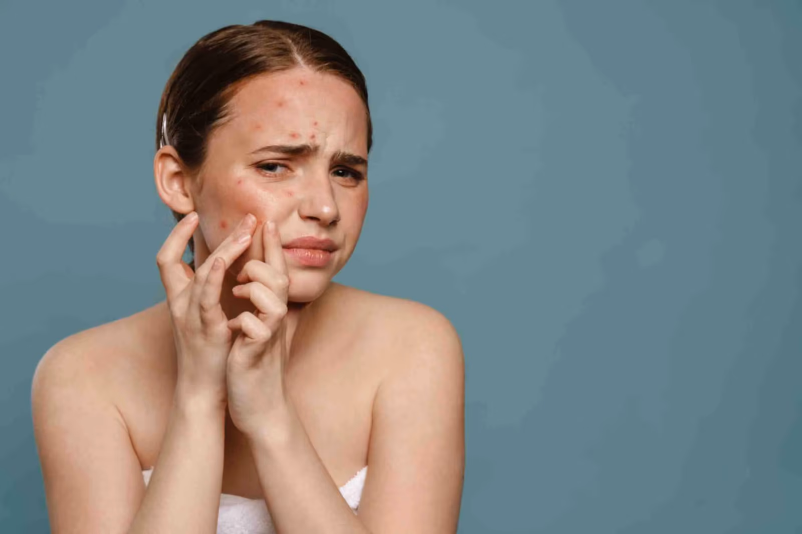 Acne Scar Treatment in Jaipur: Cost, Procedure And Result