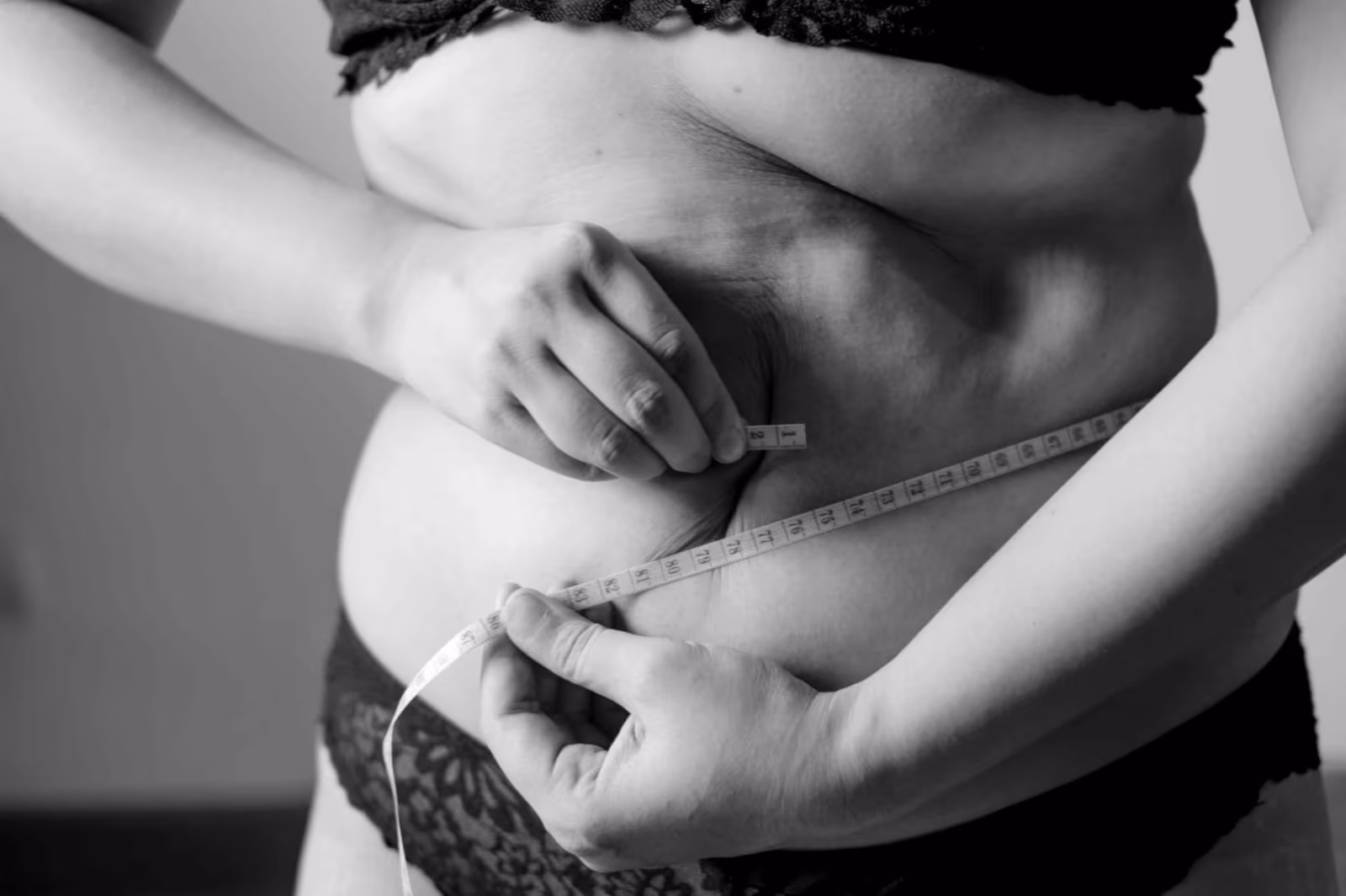 Can You Ever Actually Lose Fat Cells Through Weight Loss?