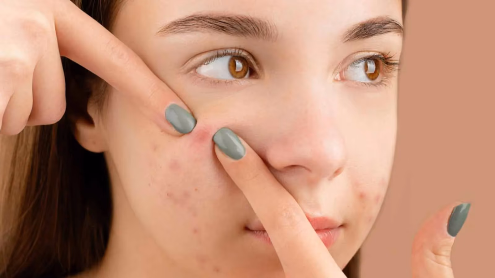 Best Dermatologist in Chennai Unlocking the Secrets to Radiant Skin