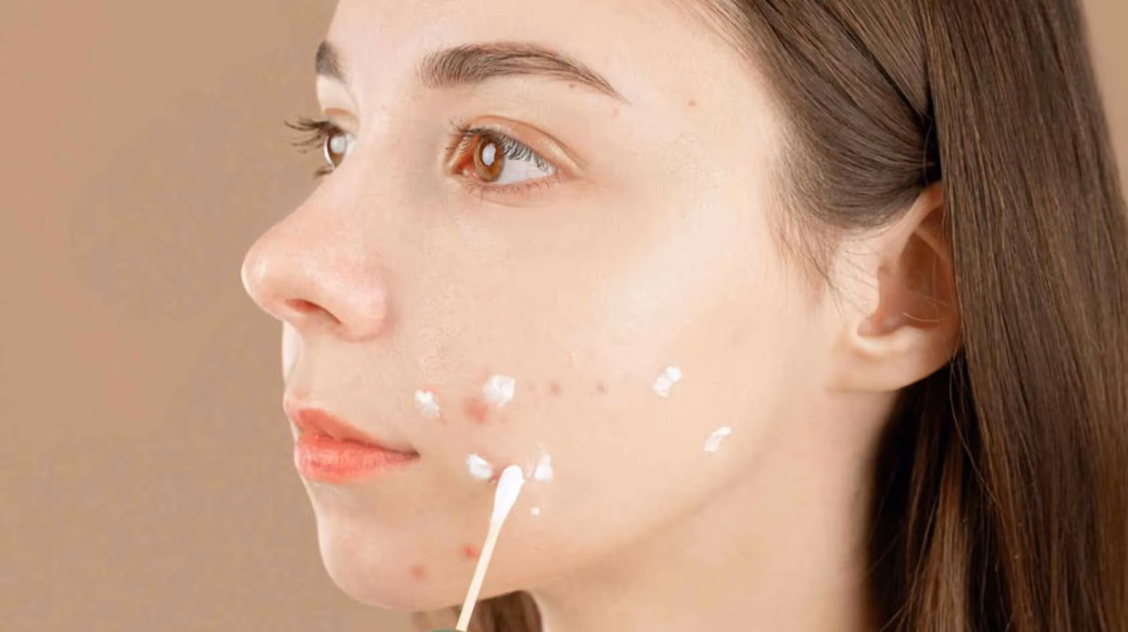 Discover Healthier Skin with the Best Dermatologist in Gurgaon