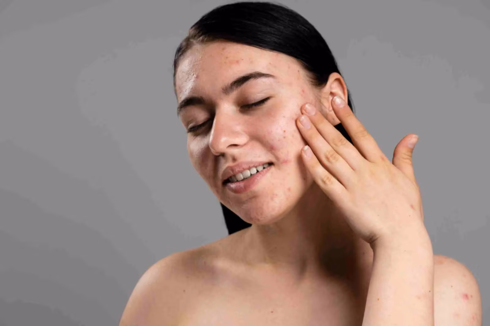 Dermatologists in Delhi: Improve Skin Imperfections with Expert Guidance