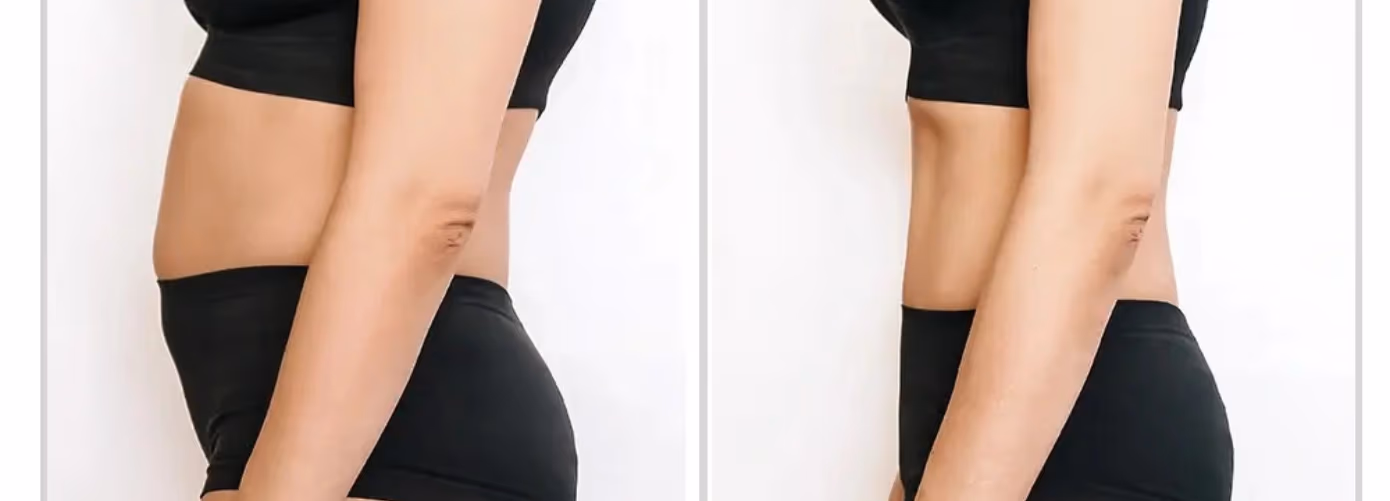 Post Pregnancy Diet Plan for Weight Loss