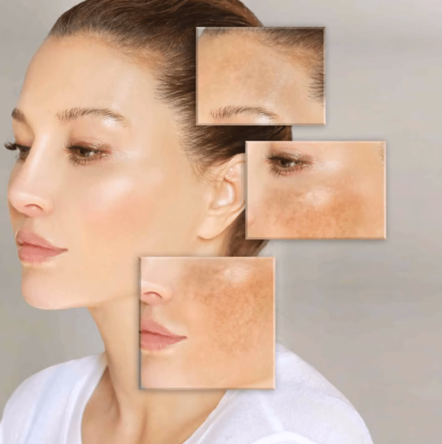 Skin Whitening Treatment in India: Costs, Facial Types, and Results