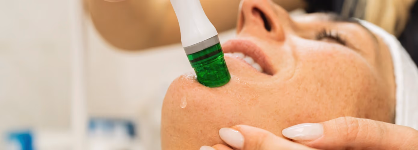 Struggling with Hormonal Acne? Here’s How HydraFacial Can Help