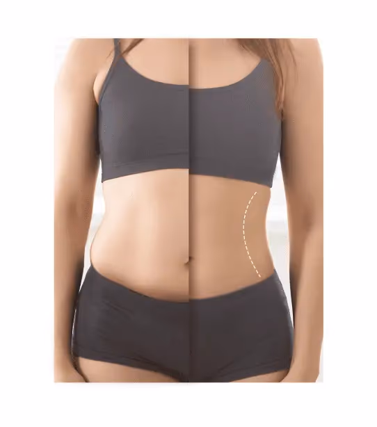 Abdominal (Belly) Fat Removal without Surgery