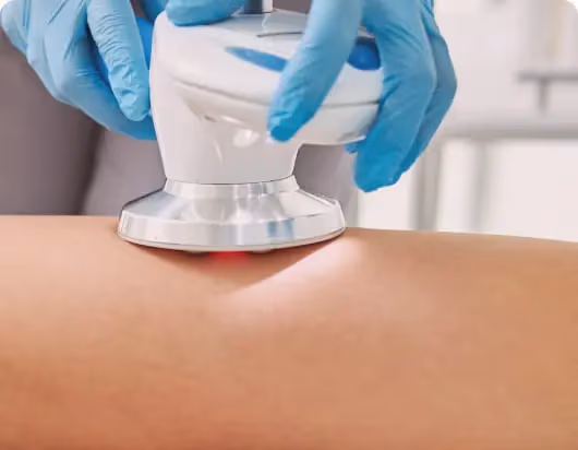 How to Reduce Thigh Fat Quickly & Safely