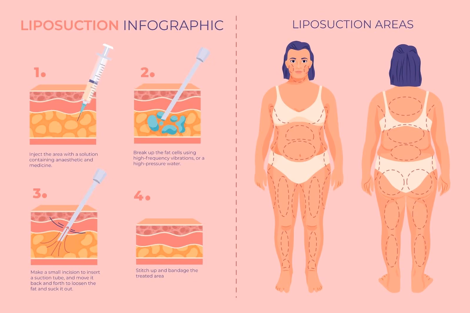 How to Reduce Thigh Fat Quickly & Safely