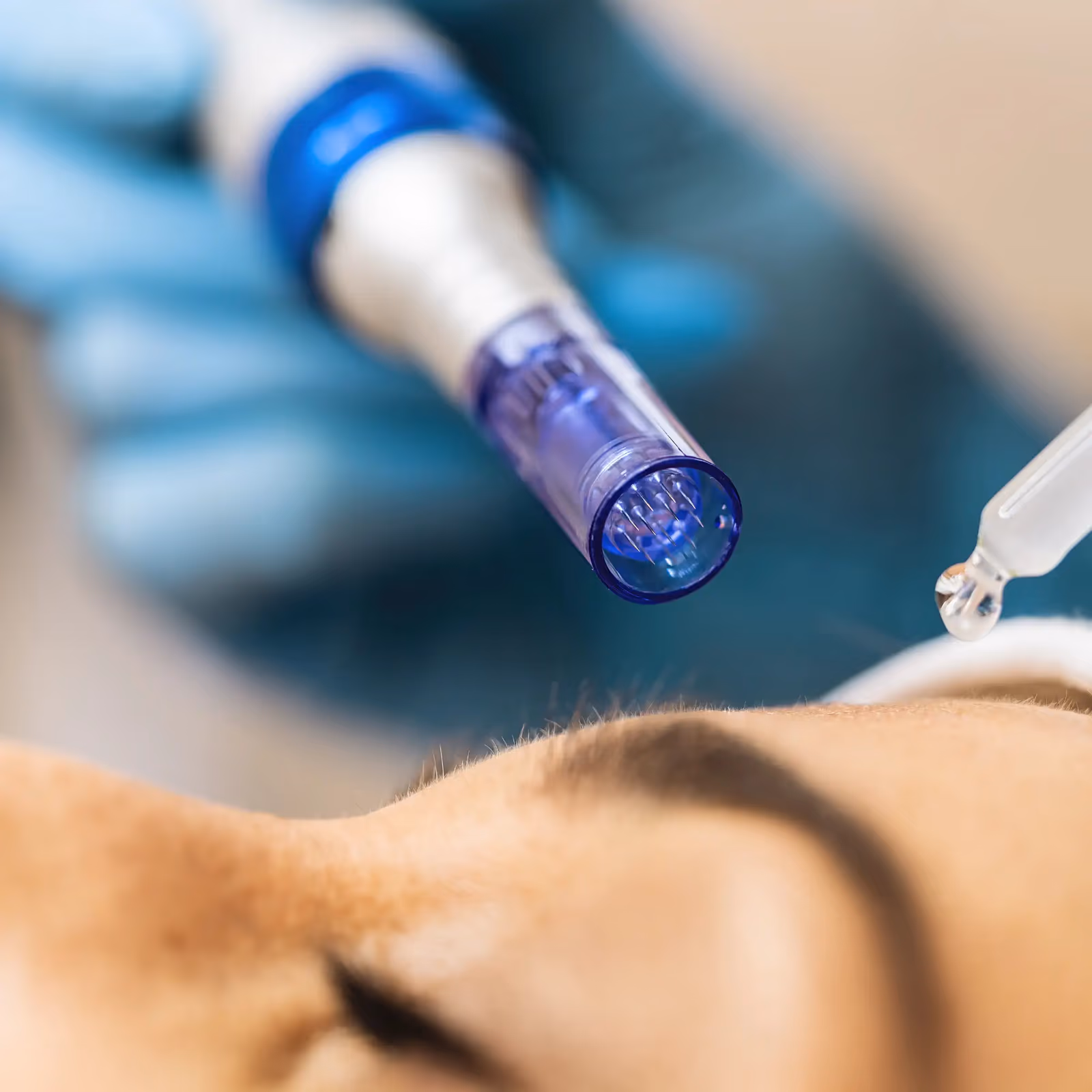 Skin-Rejuvenation-Treatments