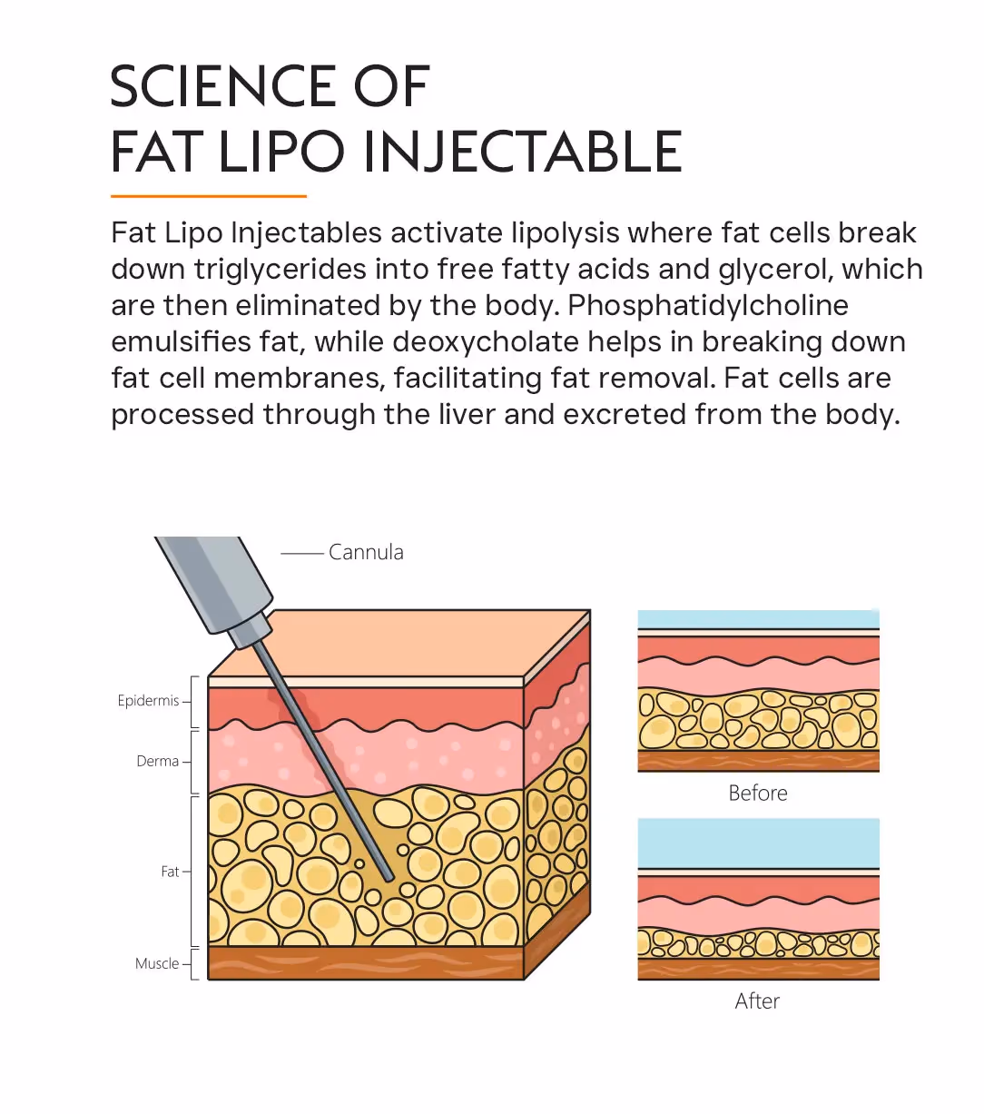 Fat Burning (Dissolving) Injections: Actual Cost & More
