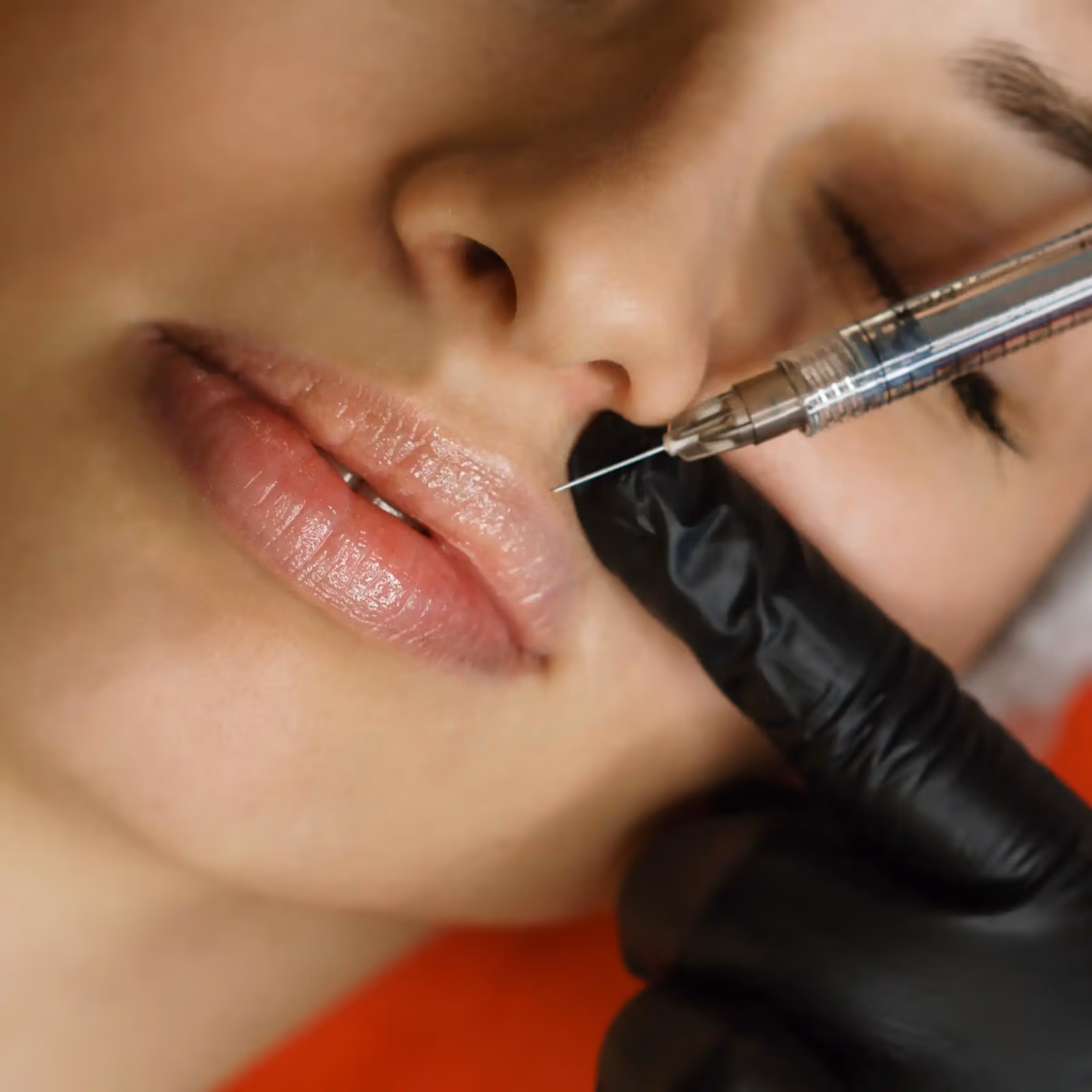 Lip Flip vs Lip Filler: Which One Will Give You the Perfect Pout?