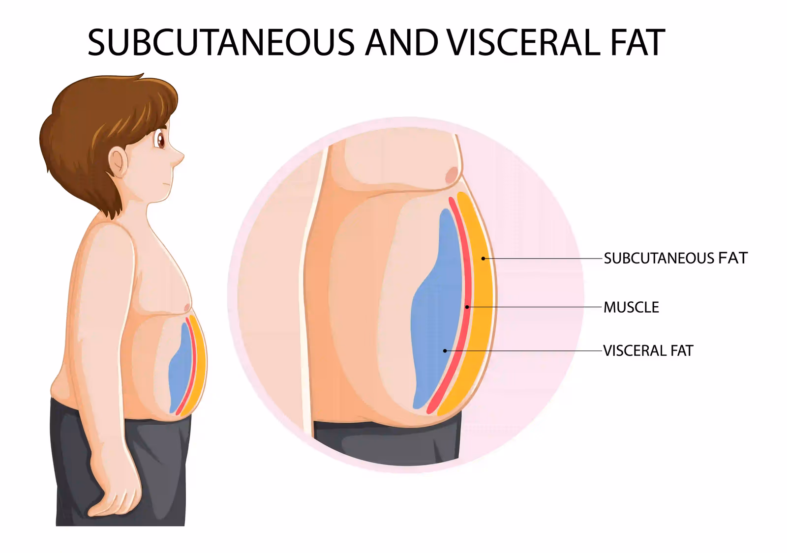 Abdominal (Belly) Fat Removal without Surgery