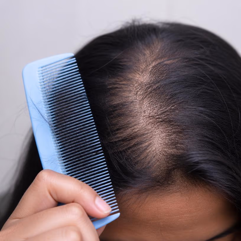 Hair Fall & Scalp Issues