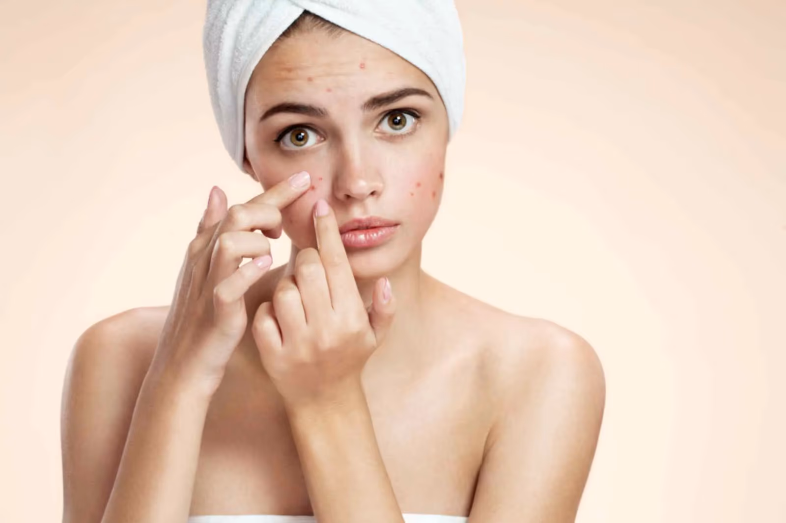 Laser Pimple Scar