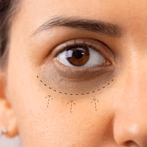 Reduces Under Eye Dark Circle