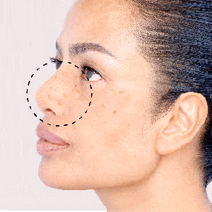Reduced Dark Spots