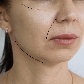 Enhances collagen production