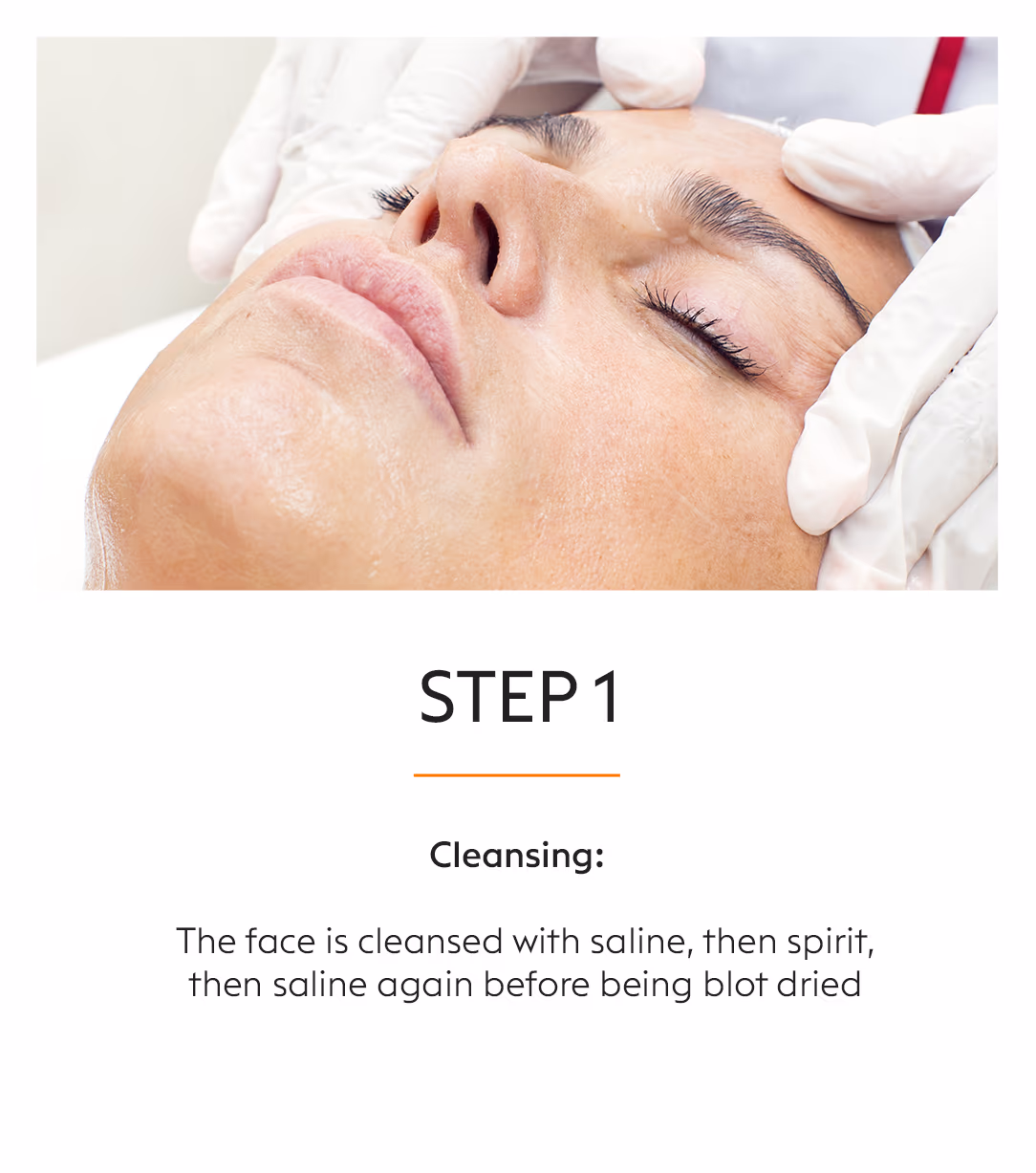 Hifu Facial Skin Tightening Treatment 3