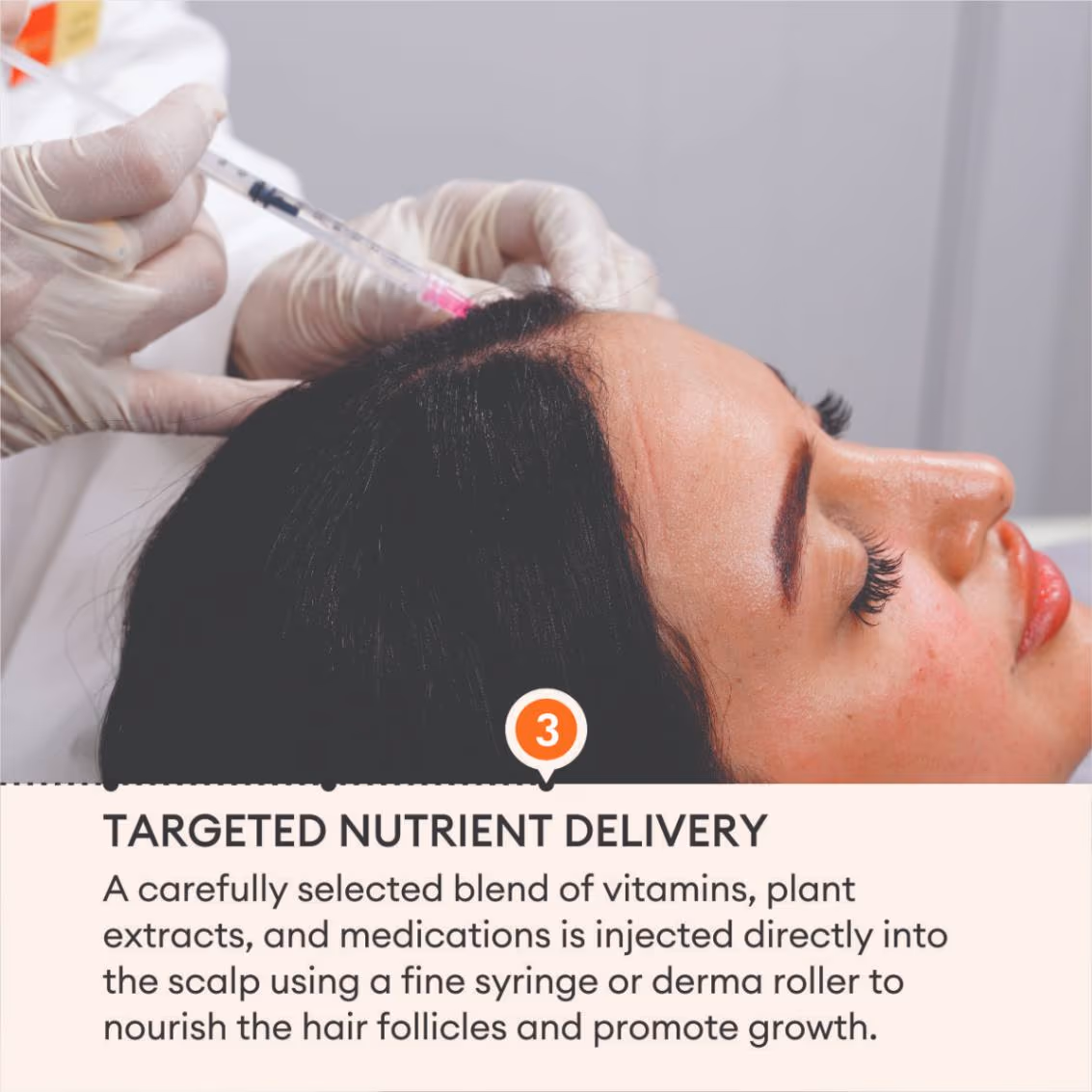 Mesotherapy 5