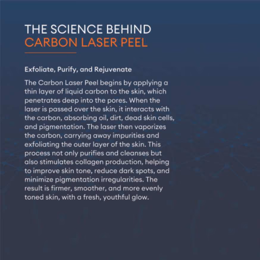 Carbon Laser Peel 2
