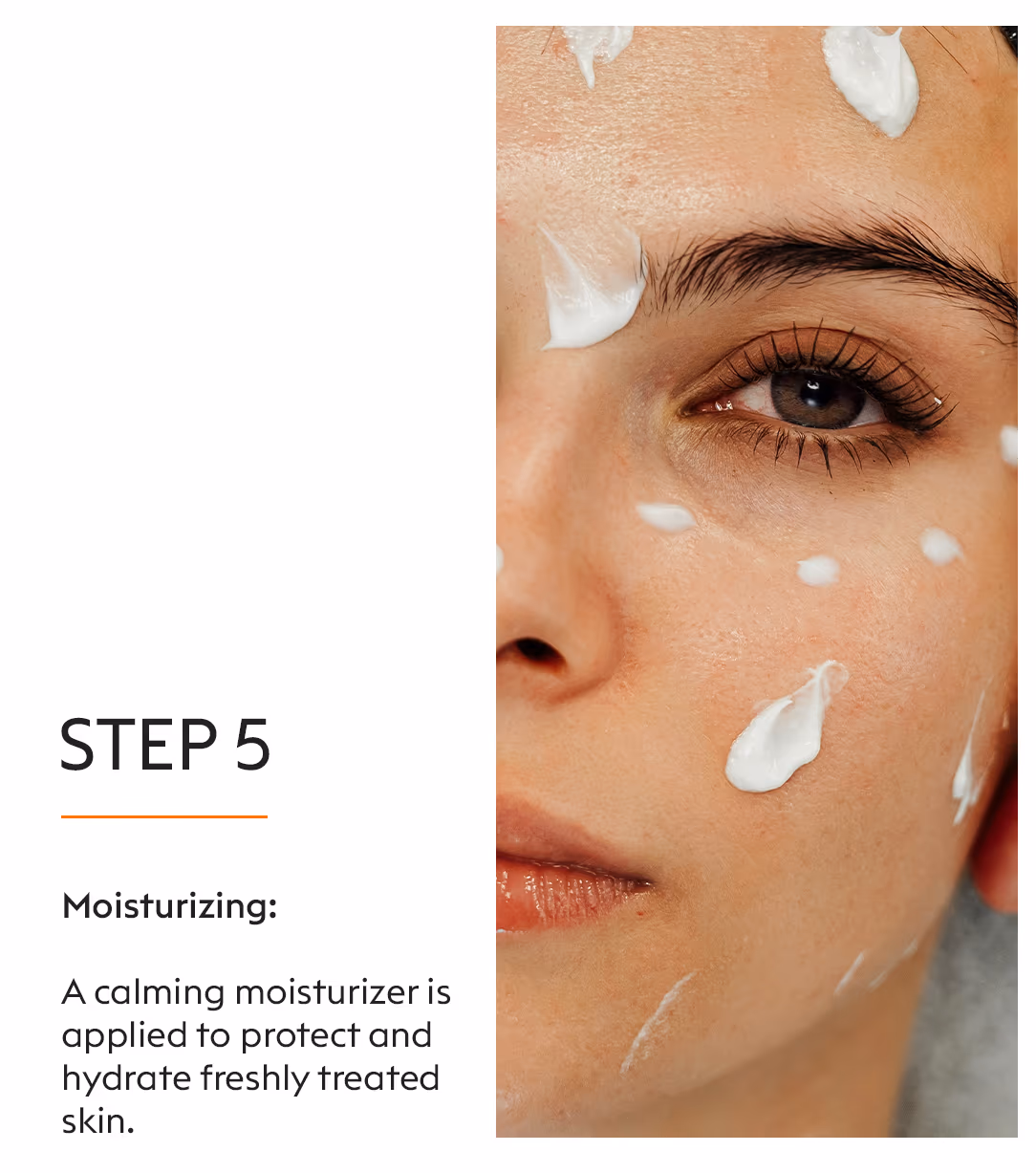 Enzymacid Peel 7