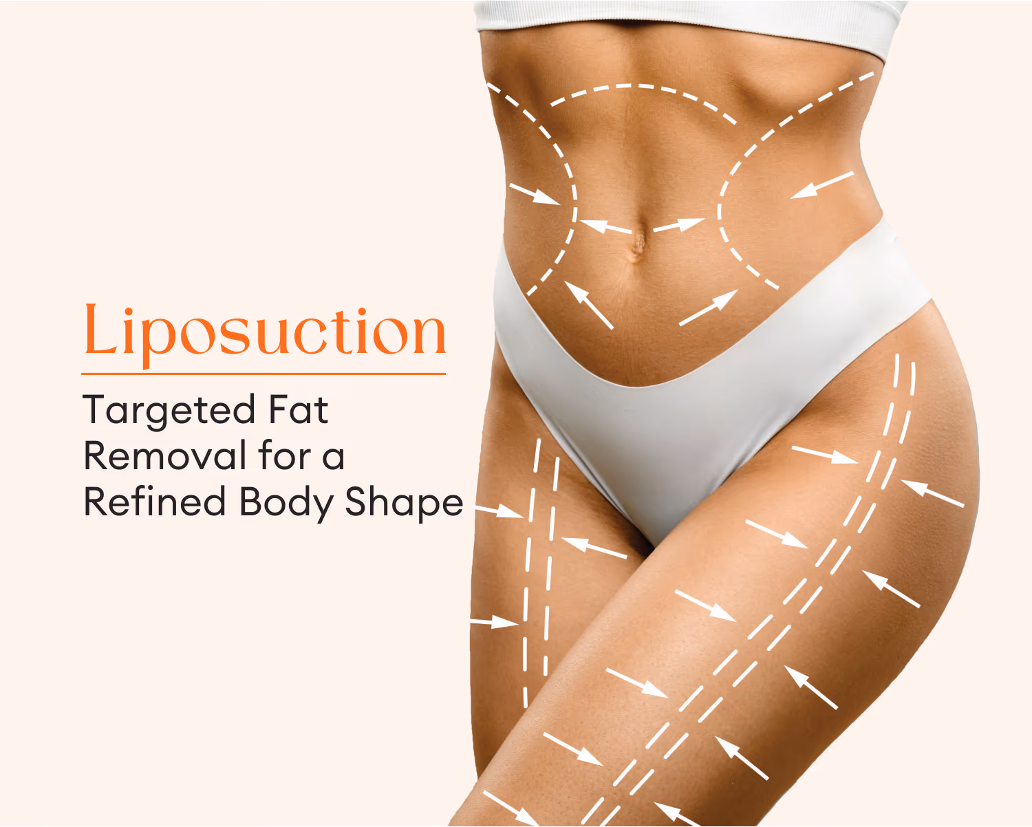 Liposuction Surgery 1
