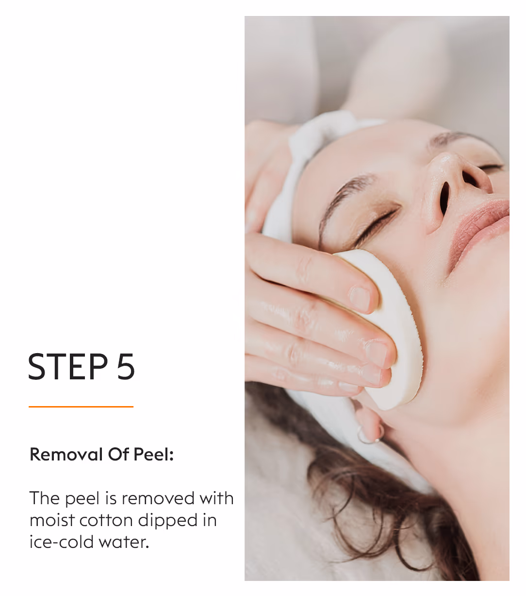 Chemical Peels Acne Scars Treatment 10