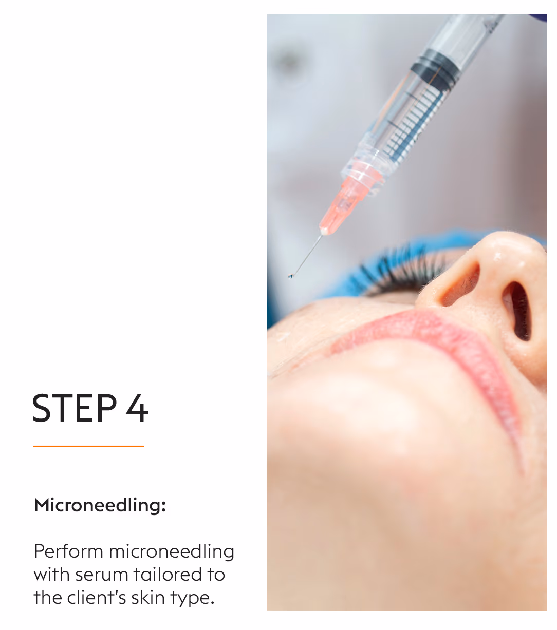 Mira Peel 6
