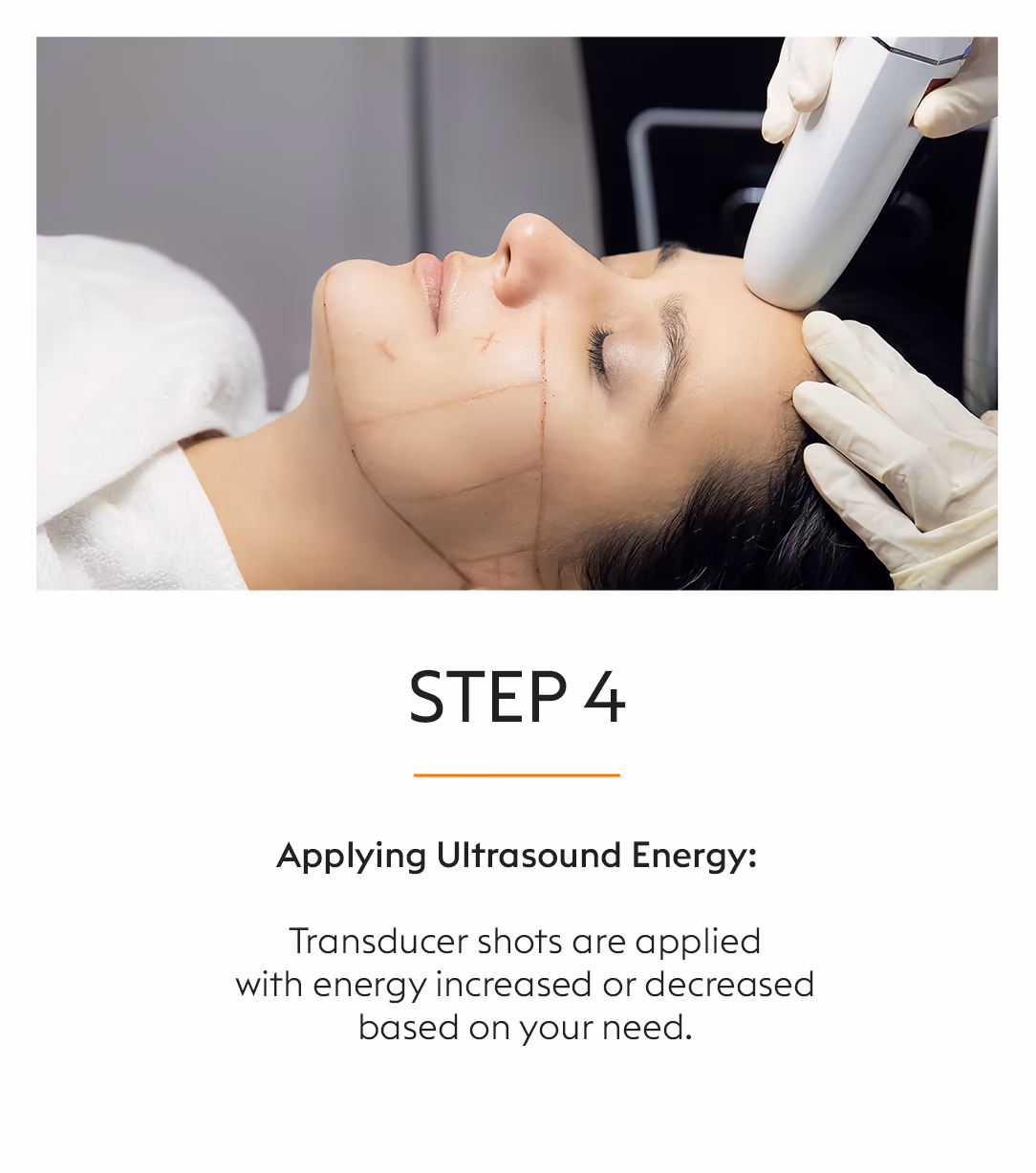 Hifu Facial Skin Tightening Treatment 6