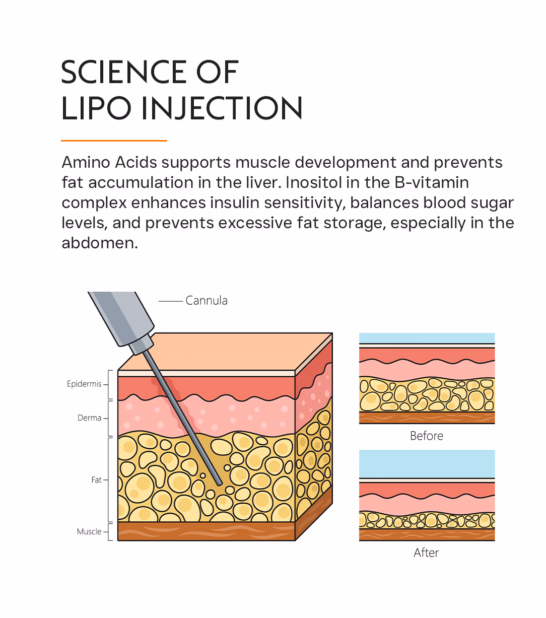 Lipo Injection 2