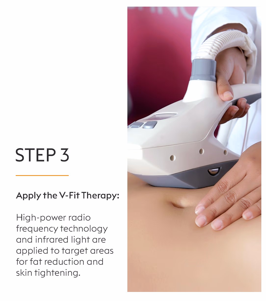 V-Fit Belly Fat Loss Treatment 5