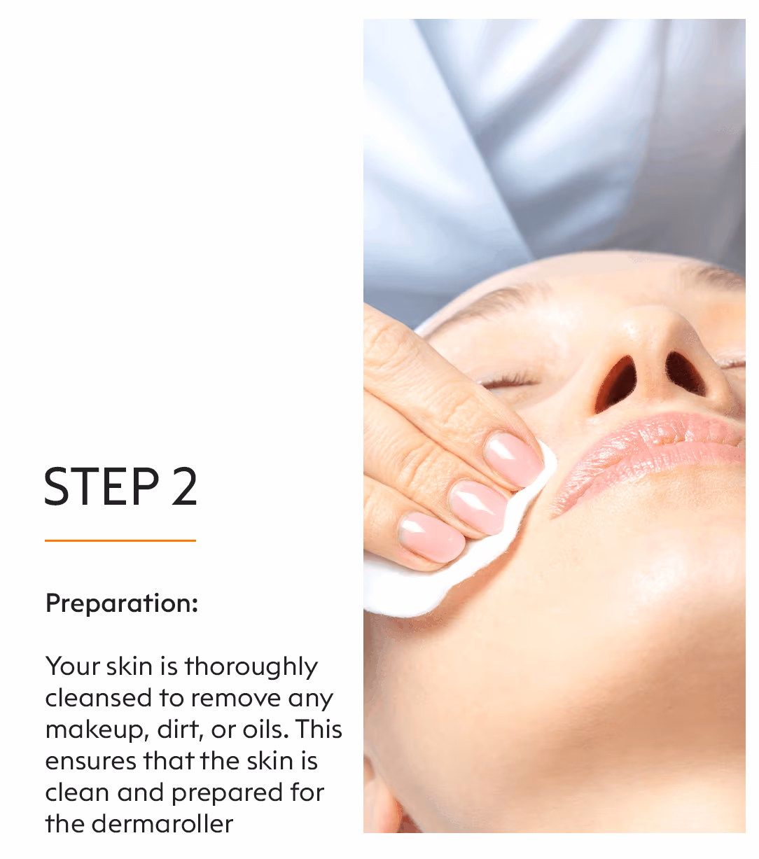 Derma Roller Microneedling Treatment 4
