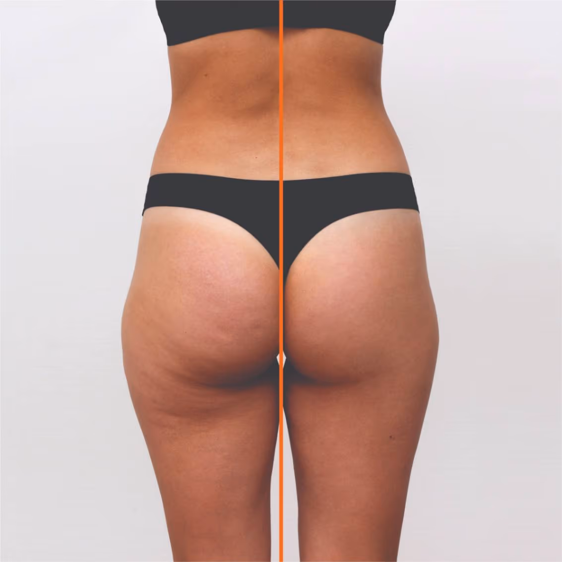 Maderotherapy 1