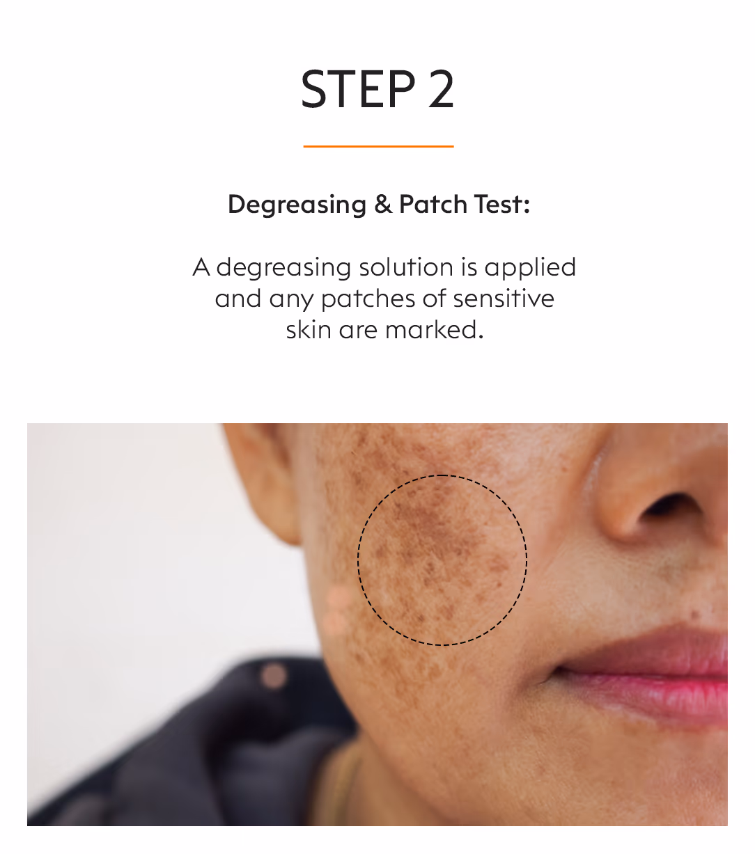 Inno Peel / Mango Peel Skin Whitening Treatment 4