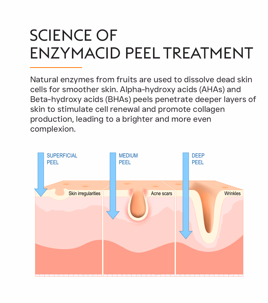 Enzymacid Peel 2