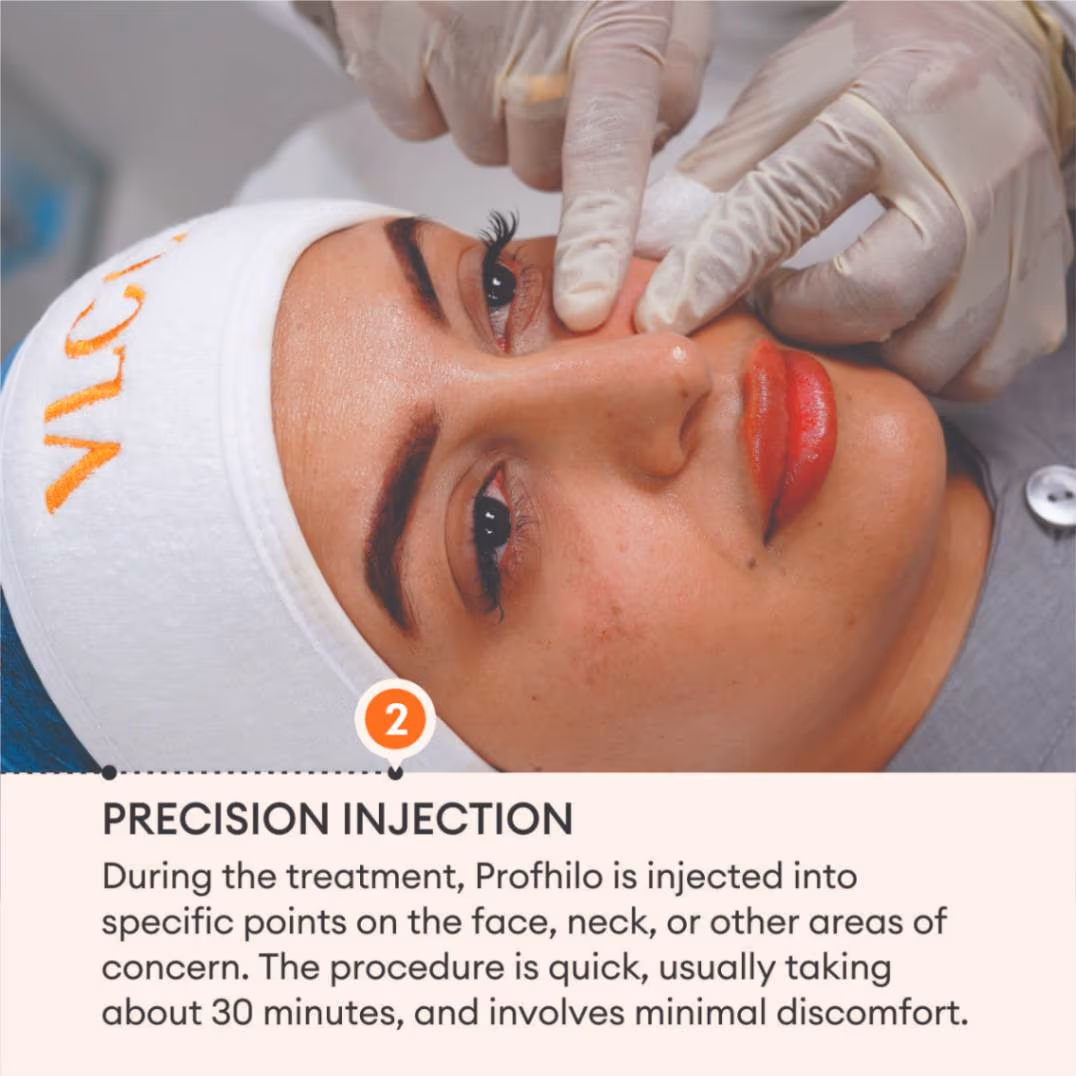 Profhilo 4