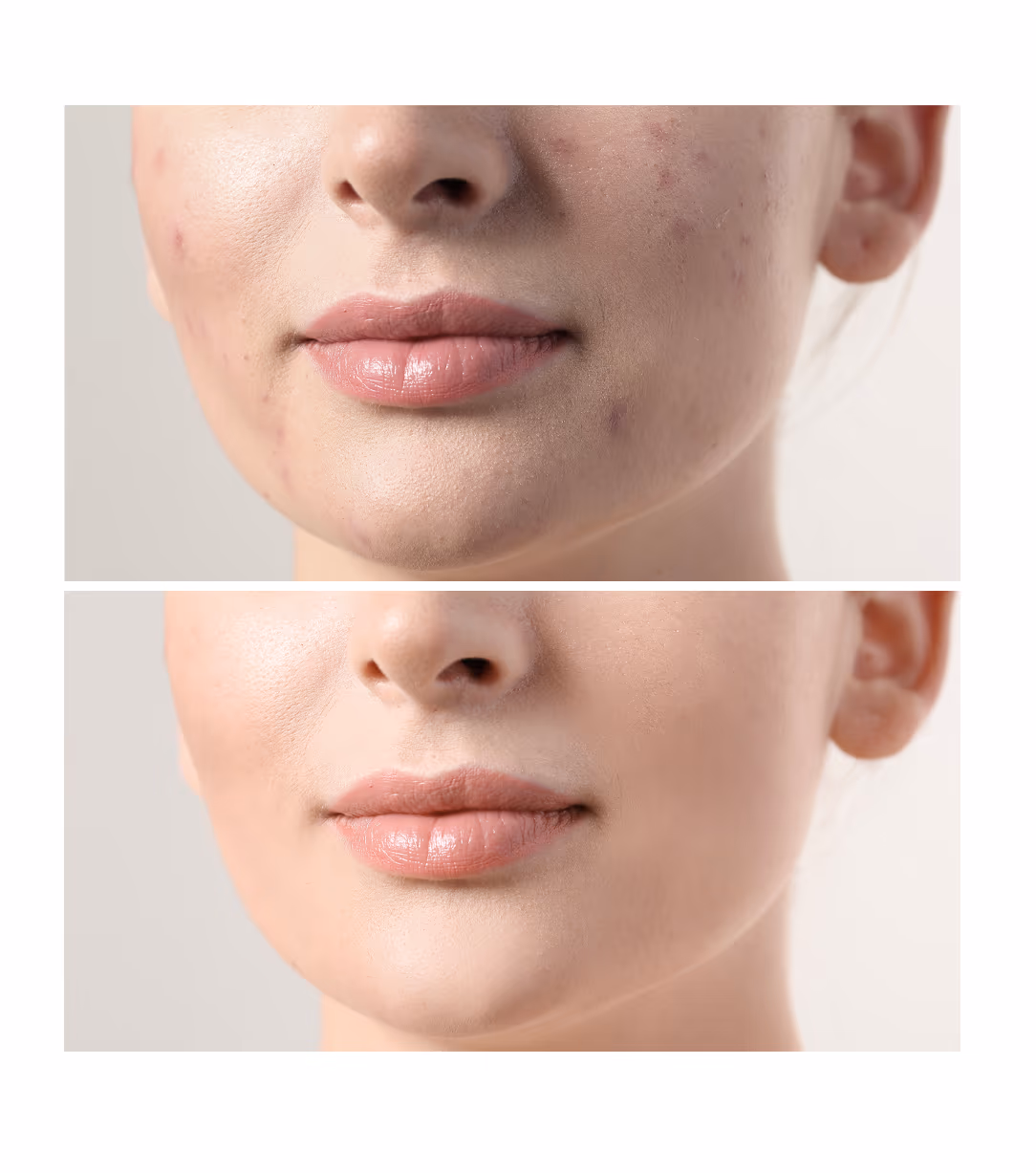 Dermaroller Topical Antioxidant 1