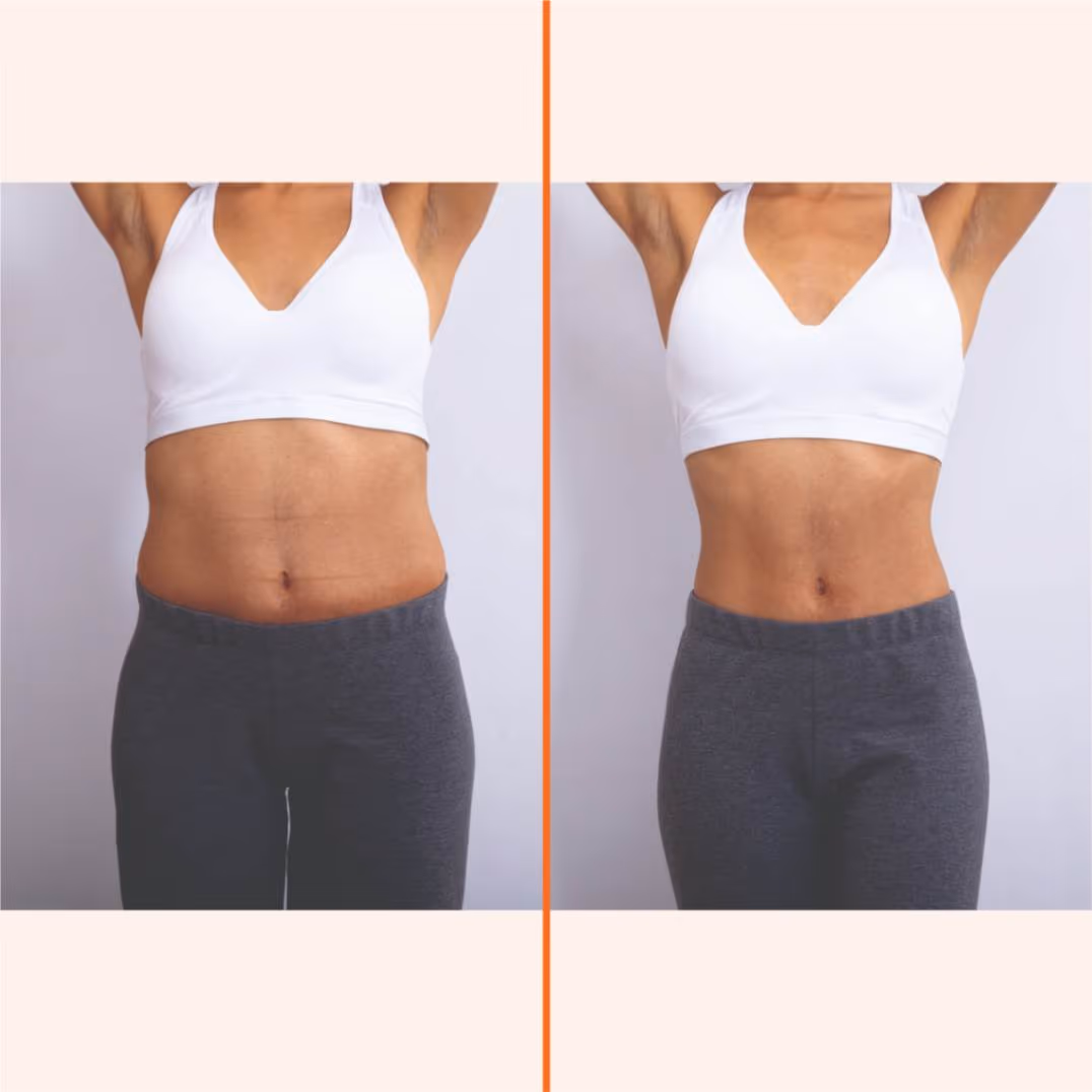 Termoslim 1