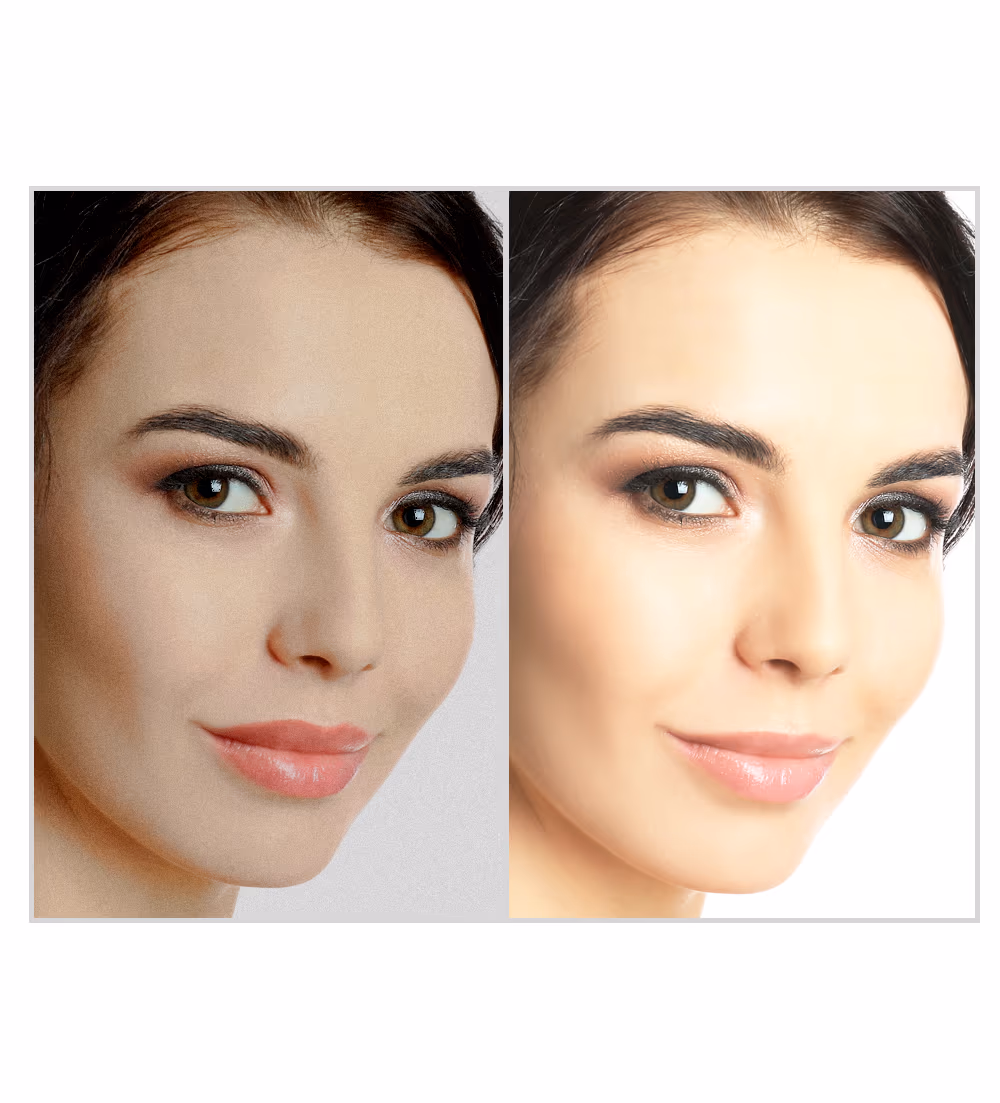 Skin Whitening Facial Treatment 1
