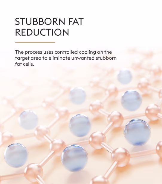 Coolsculpting Fat Loss Treatment 2