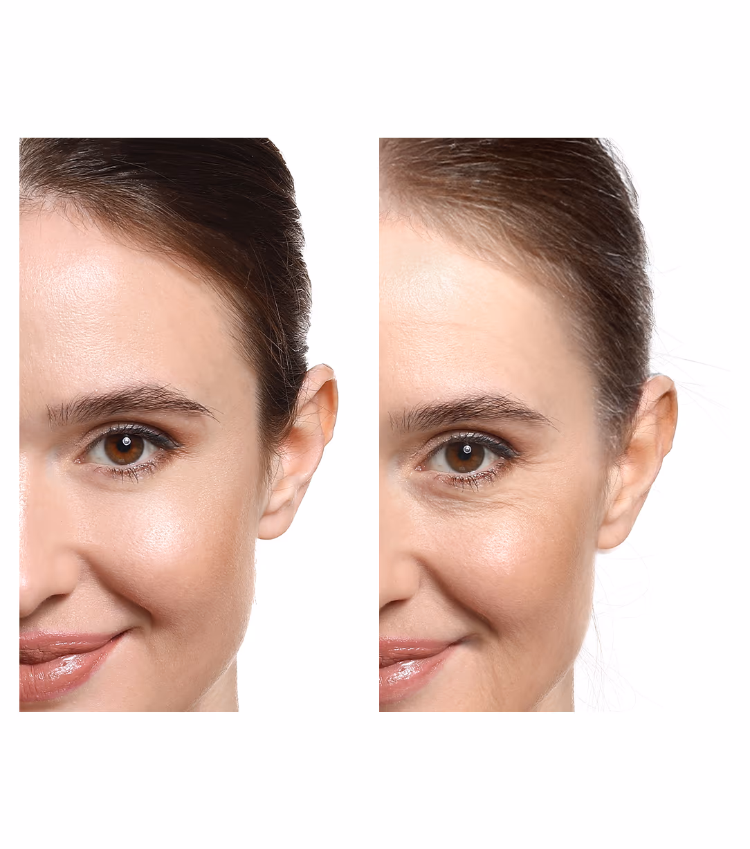 Cosmedermat for anti ageing 1
