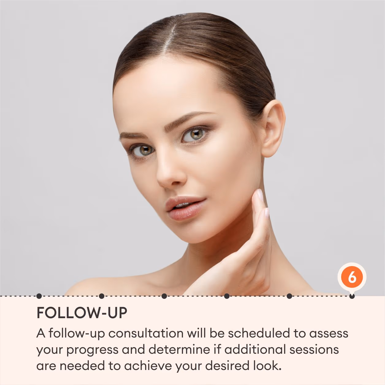 Sculptra 8